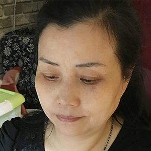 张林芳